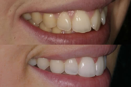 Adult & Children's Orthodontics